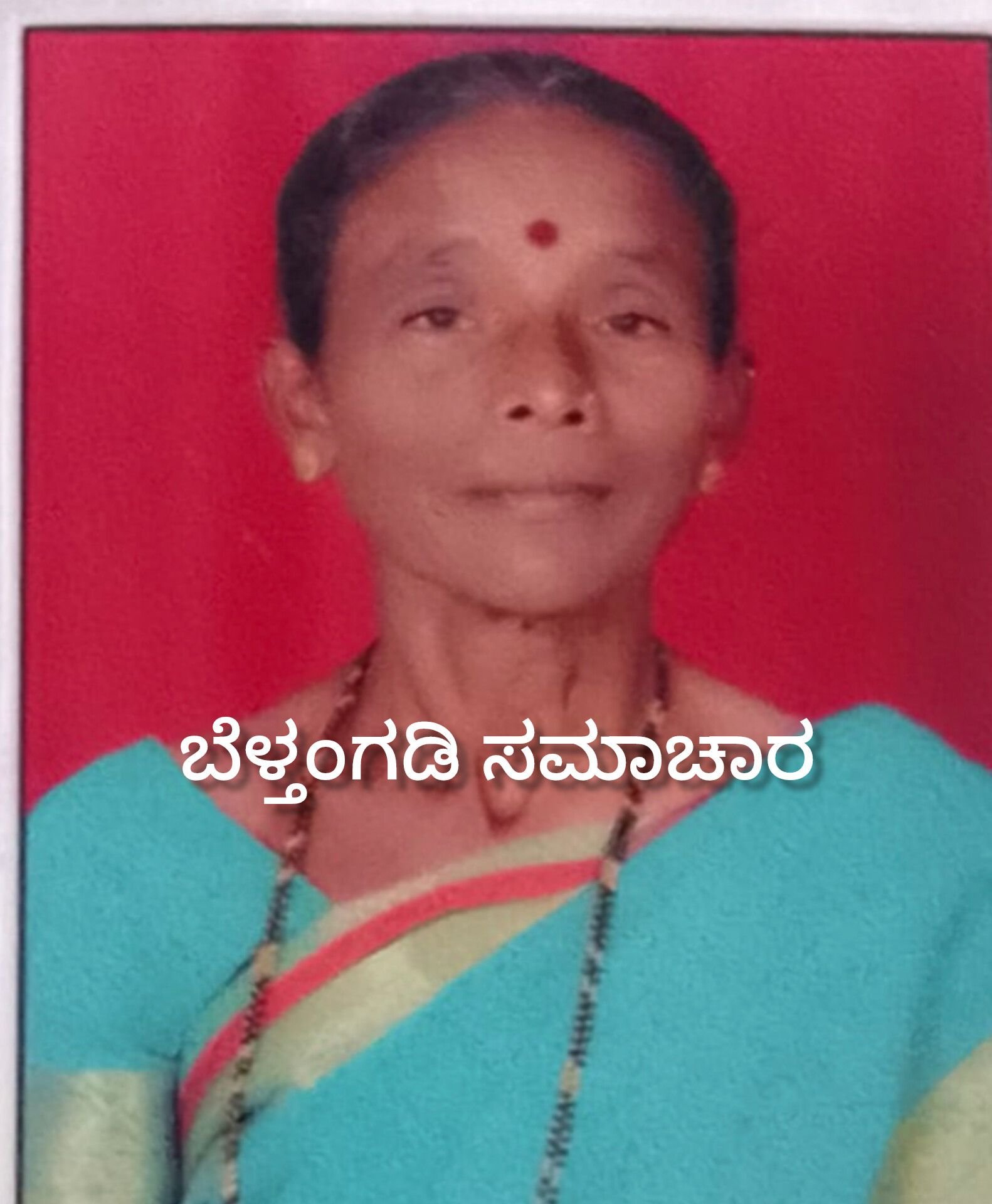 ಕನ್ಯಾಡಿ ಬೆಂಕಿ ಆಕಸ್ಮಿಕದಲ್ಲಿ ಗಾಯಗೊಂಡಿದ್ದ ಮಹಿಳೆ ಮೃತ್ಯು