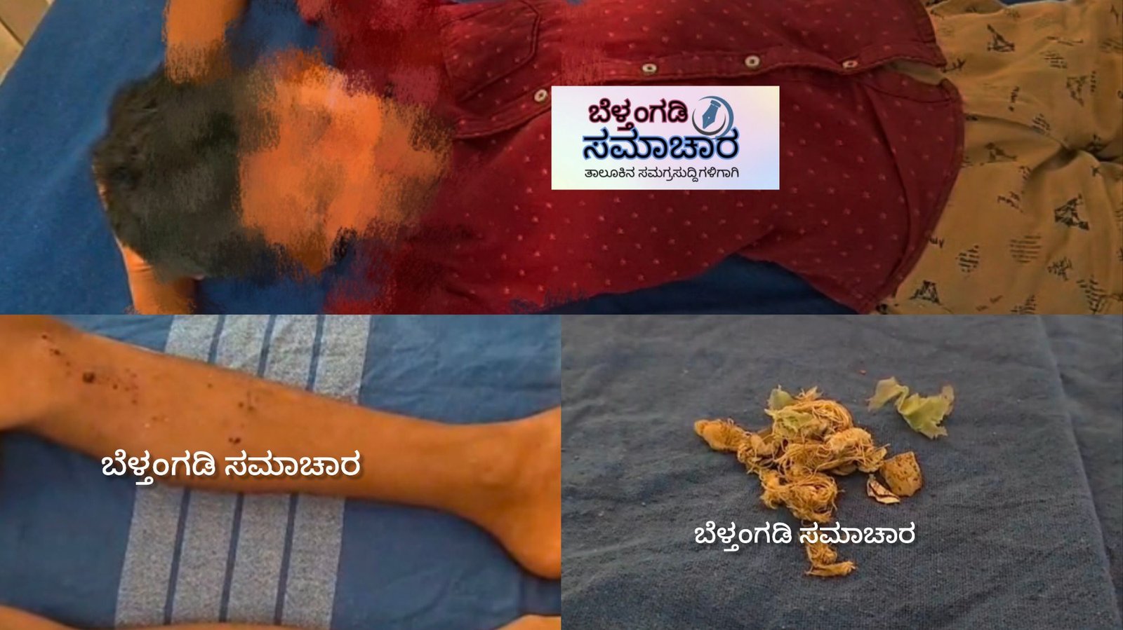 ಬಂದಾರು ಬೈಪಾಡಿಯಲ್ಲಿ ಮನೆಯಂಗಳದಲ್ಲಿ ಸ್ಪೋಟ ಬಾಲಕನಿಗೆ ಗಾಯ