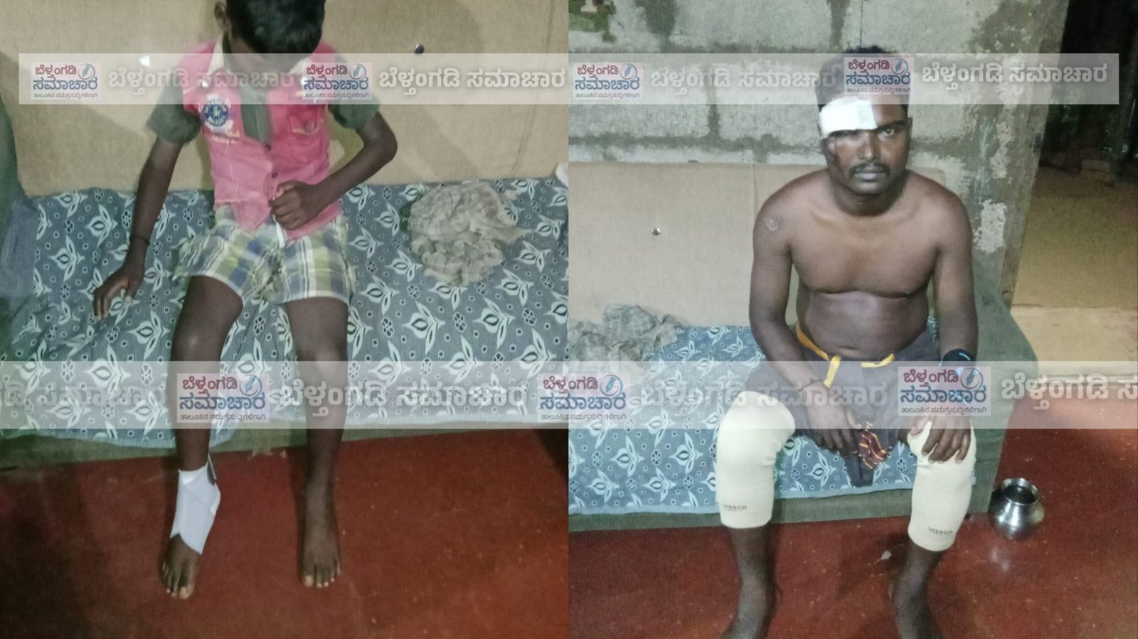 ಕೊಕ್ಕಡ ಕಾಡು ಹಂದಿ ಬೈಕ್ ಗೆ ಡಿಕ್ಕಿ ತಂದೆ ಮಗನಿಗೆ ಗಾಯ