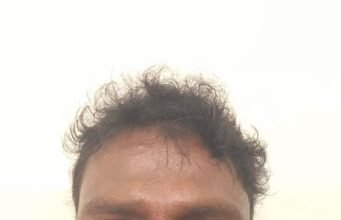 ಬೆಳ್ತಂಗಡಿ: ಕೊಲೆ ಯತ್ನ ಪ್ರಕರಣದಲ್ಲಿ ನ್ಯಾಯಾಲಯಕ್ಕೆ ಹಾಜರಾಗದ ಆರೋಪಿ ಬಂಧನ