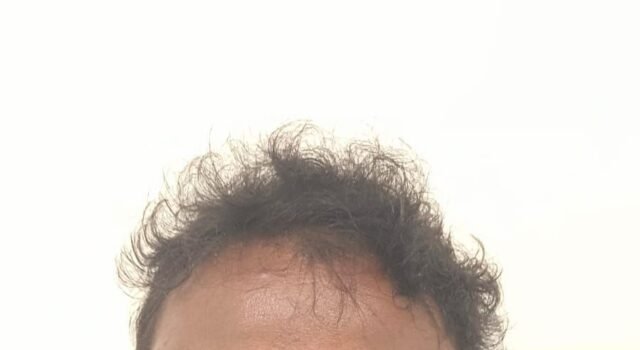 ಬೆಳ್ತಂಗಡಿ: ಕೊಲೆ ಯತ್ನ ಪ್ರಕರಣದಲ್ಲಿ ನ್ಯಾಯಾಲಯಕ್ಕೆ ಹಾಜರಾಗದ ಆರೋಪಿ ಬಂಧನ