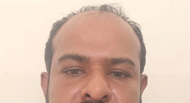 ಬೆಳ್ತಂಗಡಿ : ರೆಖ್ಯ ಲಾರಿ ಅಡ್ಡಗಟ್ಟಿ ದರೋಡೆ ಪ್ರಕರಣ; 5 ವರ್ಷಗಳಿಂದ ತಲೆಮರೆಸಿಕೊಂಡಿದ್ದ ಆರೋಪಿ ಬಂಧನ